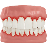 Cleanings & Gum Disease Treatment - Canton Dental