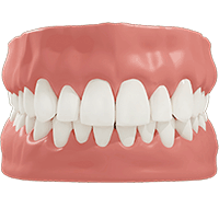 Cleanings & Gum Disease Treatment - Canton Dental